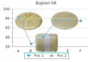 bupron sr 150 mg buy fast delivery