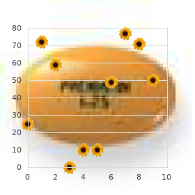 Splenomegaly