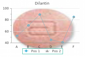 order dilantin 100 mg with amex