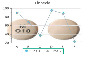 finpecia 1 mg purchase online