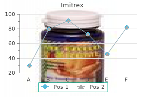 buy imitrex 100 mg without prescription