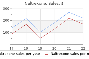 naltrexone 50 mg discount otc