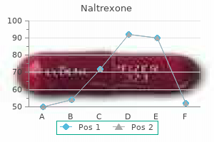 order naltrexone 50 mg amex