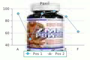 purchase 40 mg paxil mastercard