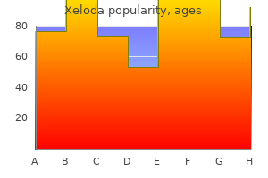 500 mg xeloda buy otc